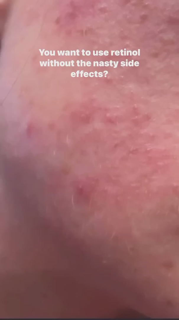 VITALITY 1 | Vitamin A Serum